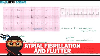 Rate and Rhythm  Atrial Fibrillation and Atrial Flutter [upl. by Sundstrom]