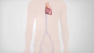 Radiofrequency Catheter Ablation [upl. by Dieball]