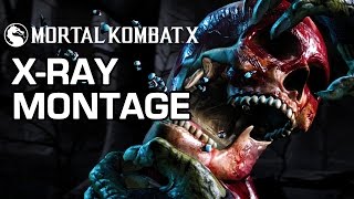 Bone Crunching XRays  Mortal Kombat X [upl. by Dell]