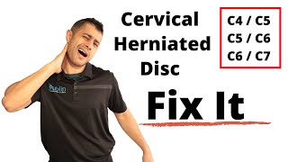 Cervical herniated disc exercises [upl. by Gnauq]