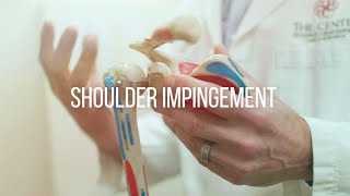 Shoulder Impingement Causes and Treatment [upl. by Fowkes]