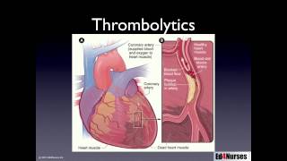 Percutaneous Coronary Interventions [upl. by Gilberto47]