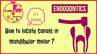 Mandibular first molar  access opening  Endodontics  RCT  easy tips [upl. by Schwitzer]