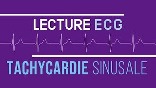 Interprétation ECG  Tachycardie Sinusale [upl. by Lavine867]