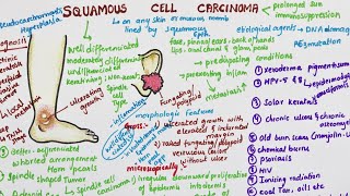 Squamous Cell Carcinoma  Pathology [upl. by Eidnar]