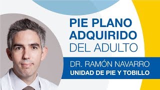 Pie Plano Adquirido Del Adulto causas síntomas y tratamiento [upl. by Esbensen]