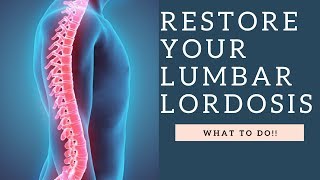 RESTORE Lumbar Lordosis amp The Curvature Of The Spine With These Exercises How To Demo [upl. by Riobard]