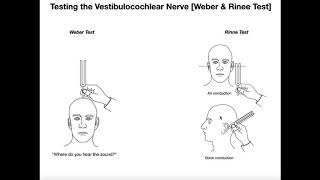 Interpreting the WeberRinne Tests EXPLAINED [upl. by Arturo]