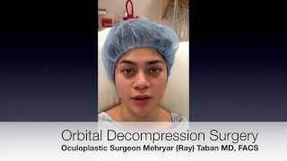 Orbital Decompression Surgery Los Angeles Beverly Hills [upl. by Nuy443]