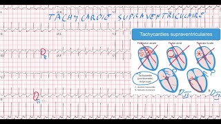 20 ECG  Quiz  Dr Synapse [upl. by Olpe252]