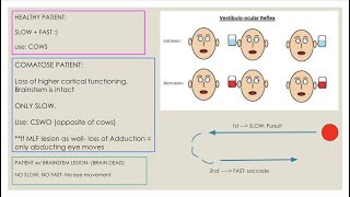 Caloric Testing Vestibulooccular relfex [upl. by Neiv]