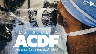 C56 C67 Anterior Cervical Discectomy and Fusion  Case Trailer [upl. by King59]