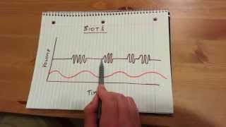 Biots Respiration [upl. by Atteselrahc577]