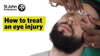 How to Treat An Eye Injury  First Aid Training  St John Ambulance [upl. by Kcirtapnaes]