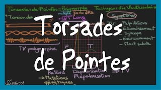 Torsades de pointes ECG symptômes causes et traitement [upl. by Basir]