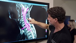 Symptoms of Cervical Stenosis  Jeffrey Cantor MD [upl. by Nyleuqaj]