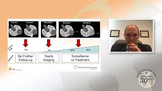 Small Renal Masses An Overview [upl. by Klayman922]