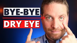 How To Get Rid Of Dry Eyes  4 Advanced Home Treatments [upl. by Bannerman]