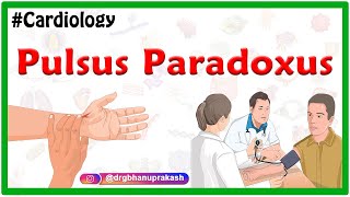 Pulsus Paradoxus  Examination of the arterial pulse  Cardiology USMLE [upl. by Wakeen]