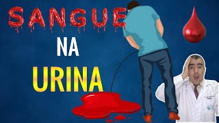 SANGUE na urina [upl. by Nahbois]