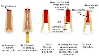 Intravenous IV Cannulation  An Essential Guide [upl. by Scammon]