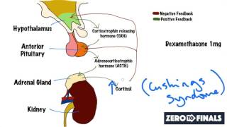 Understanding The Dexamethasone Suppression Test [upl. by Ettelrahc484]