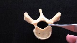 Typical Vertebra  Spinal column  Anatomy [upl. by Ijies]