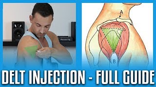 How To Do A Deltoid Injection  Full GuideDemo [upl. by Nabla]