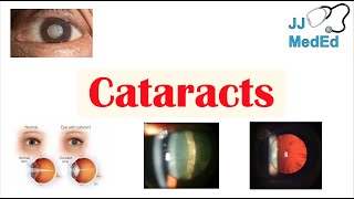 Common Eye Conditions Explained [upl. by Notsa739]