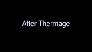 Thermage Side Affects  After Thermage Treatment [upl. by Crelin]