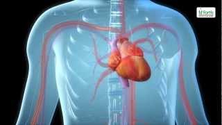 TAVI Transcatheter Aortic Valve Implantation [upl. by Nois265]