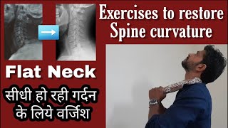 How to restore cervical curve  Exercises for straightening of cervical spineLoss of Lordosis [upl. by Dwayne]