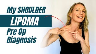 My Shoulder Lipoma Diagnosis Pre Op Story [upl. by Ayom155]