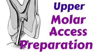 Upper Maxillary Molars  Endodontic Access cavity Preparation Endodontic Lecture amp Tutorial [upl. by Laszlo]