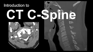 Introduction to CT Cspine Approach and Essentials [upl. by Aicirtal]