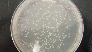 CFU Colony Forming Unit amp cfuml calculation [upl. by Thea460]