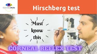 Hirschberg Test II Corneal light reflex test [upl. by Wendy]