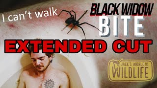 Black Widow BITE The EXTENDED CUT [upl. by Ettesoj346]