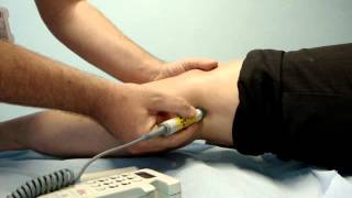 Popliteal pulse assessment with Doppler 8  5mhz probes [upl. by Tehcac]