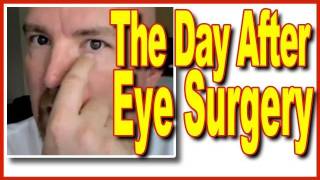 Surviving Eye Surgery  The Day After Chalazion Part 2 [upl. by Clair250]