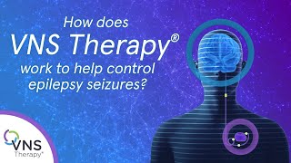 How does VNS Therapy Epilepsy Treatment Work [upl. by Ehtylb760]