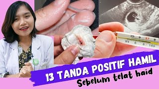 13 Tanda Positif Hamil sebelum Telat Haid  dr Emasuperr [upl. by Lemcke545]