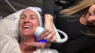 Cold Facial Freeze Tighten and Tone [upl. by Esta]