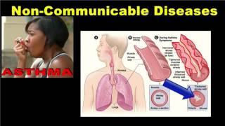 Noncommunicable Diseases [upl. by Palua]