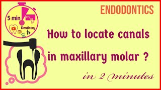 Access opening  Locating canal orifices quickly  Maxillary first molar  easy tips [upl. by Hendren]