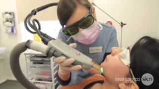 Laser Hair Removal  How does it work [upl. by Nwonknu]